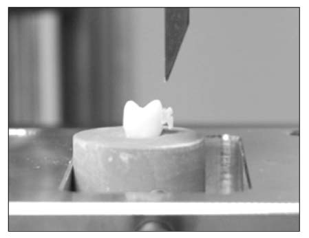 <b>Shear bond strength test to debond the bracket from tooth clamped in mounting jig.</b><br />
 
