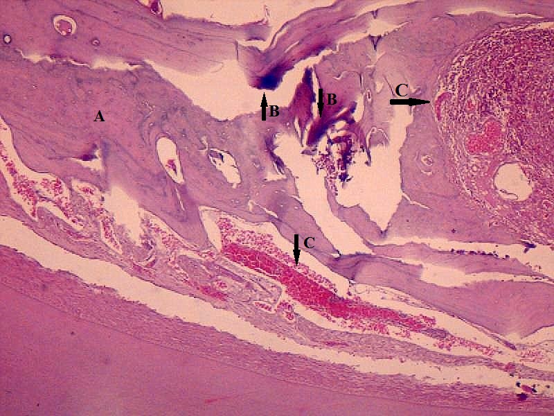 Photomicrograph from maxilla of an experimental animal in high dose group showing bony trabeculae with degenerative changes (A), calcification (B) and extensive haemorrhage (C). (H&E, 100x)