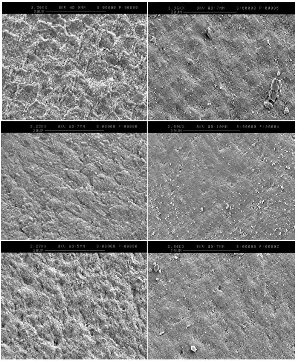Top: High magnification SEM (approximately 2000X) of the eroded human enamel (left) and the subsequently abraded surface (right). Note the loss of interprismatic enamel and surface roughness, whilst retaining much the same general surface form.<br />
Middle: High magnification SEM (approximately 2000X) of the eroded ovine enamel (left) and the subsequently abraded surface (right). Note the loss of prism ridging and surface roughness, resulting in a somewhat amorphous surface.<br />
Bottom: High magnification SEM (approximately 2000X) of the eroded bovine enamel (left) and the subsequently abraded surface (right). Note the loss of enamel ridges and surface roughness, whilst retaining much the same general surface form.