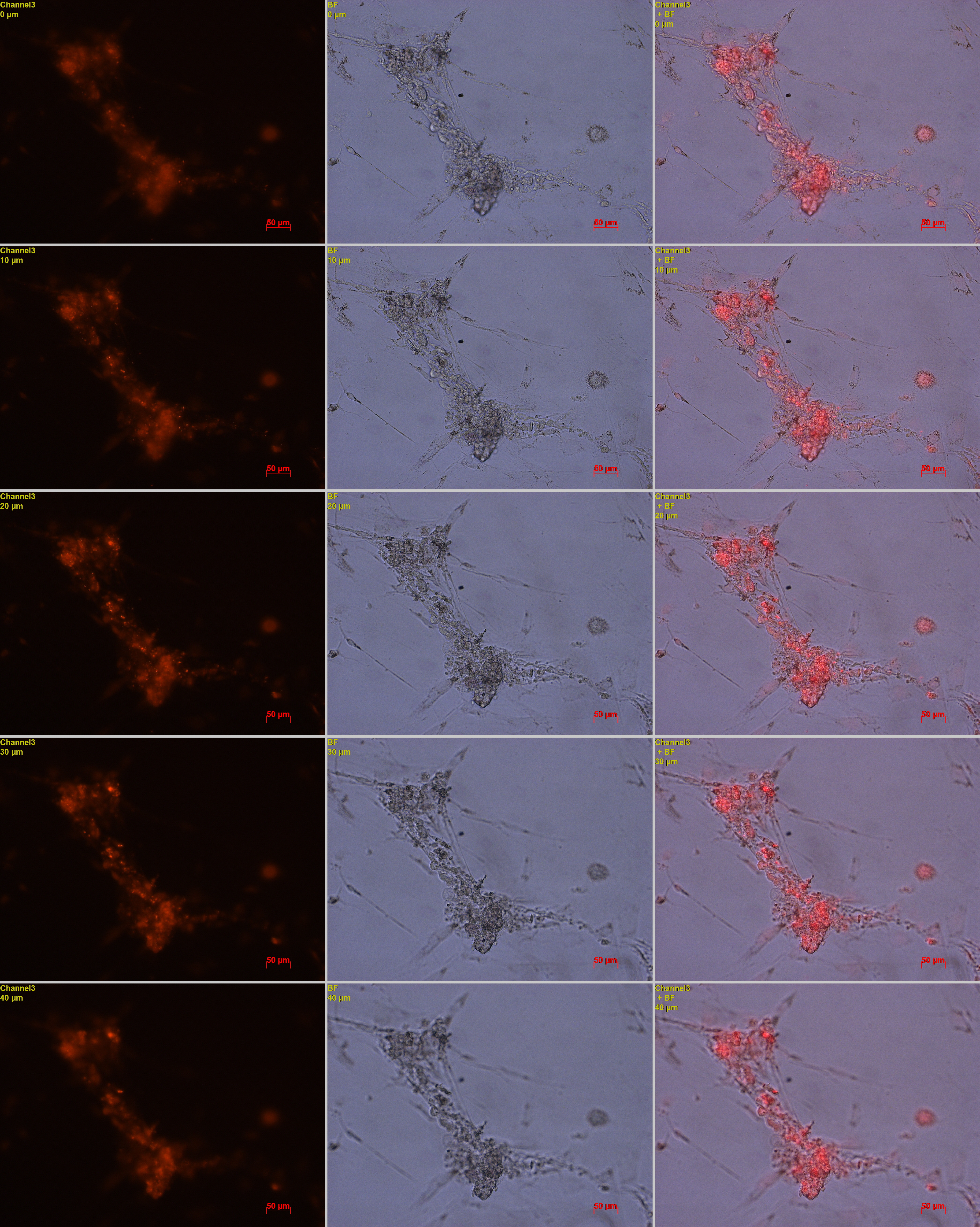 Z-stack images of ADSCs after indirectly co-cultured with SA cells for 2 weeks. Three-dimensional SA-like structures with α-amylase expression (marked in red) were observed.