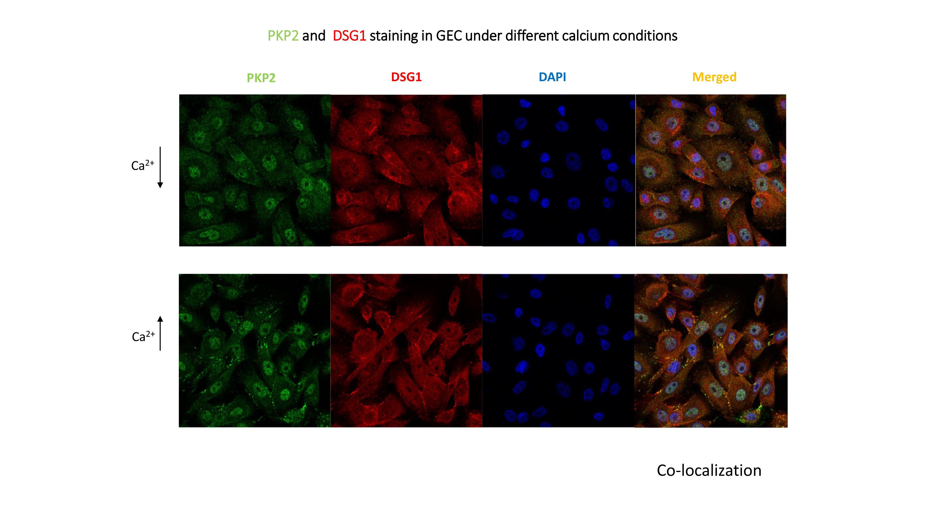 PKP2 and DSG1 form colocalizations under high Ca<sup>2+</sup> condition