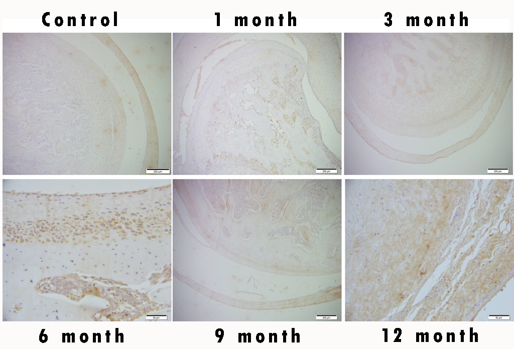 Expression of Cadherin-11 in BS2 guinea pigs (control), and DH guinea pigs with age of 1-, 3-, 6-, 9-, and 12 months.
