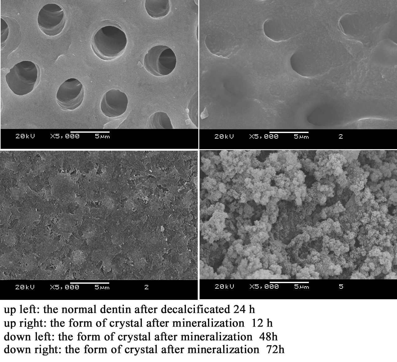 <b>SEM images of neonatal crystal</b>