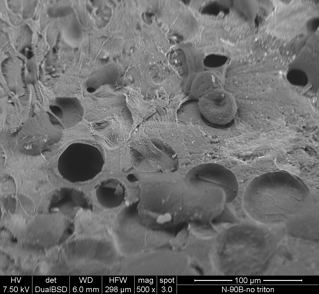 SEM image of Filopodia of fibroblast inserting the porous surface of the acrylic made custom provisional abutment.