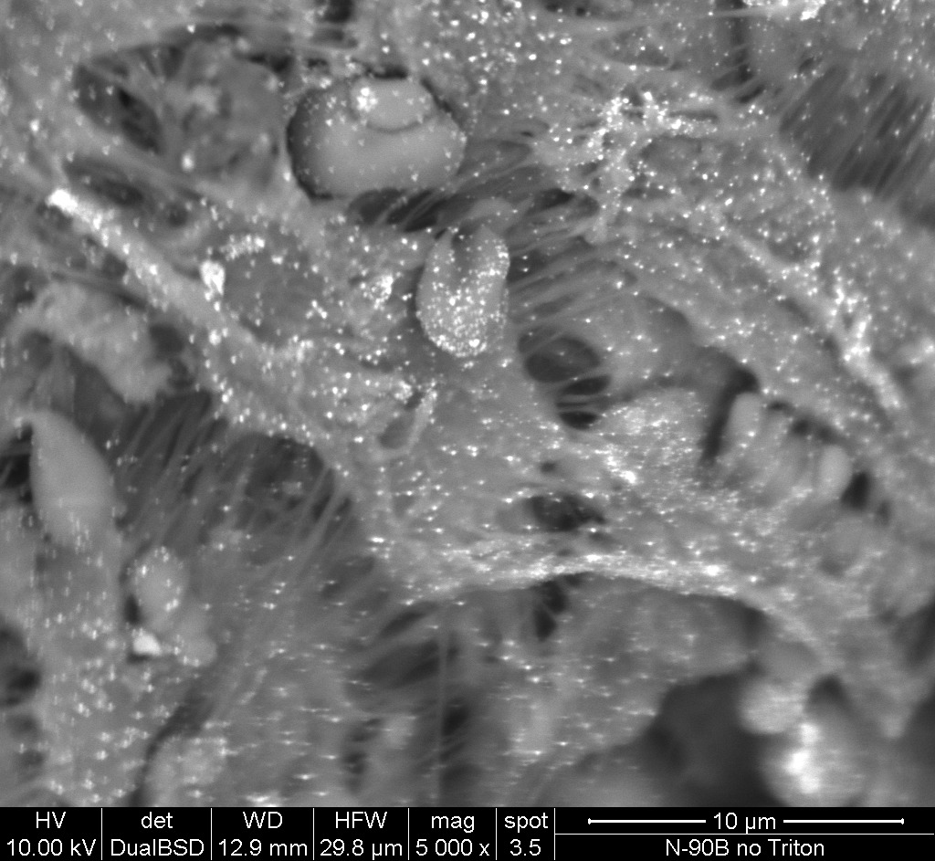 Immunogold labeled fibroblast on the surface of custom provisional abutment under backscattered microscope.