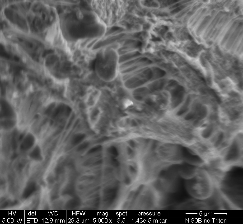 Corresponding area under SEM.