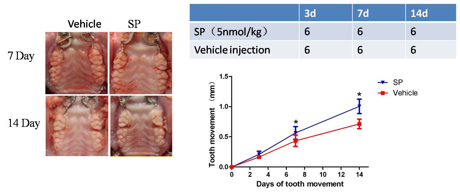 Intraoral photographs of tooth movement and the time course of orthodontic tooth movement.