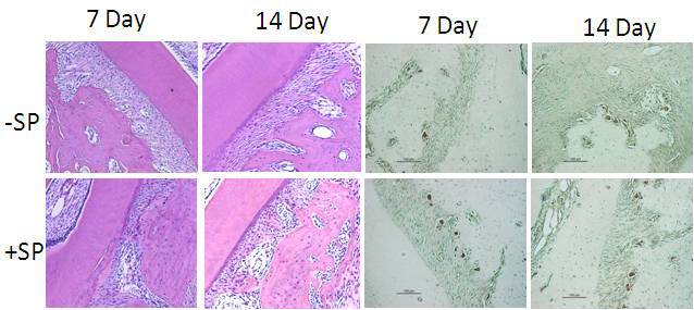 Hematoxylin and eosin staining and TRAP staining. The red arrows indicate the area of bone resorption; the blue arrows indicate the area of bone deposition; the black arrows indicate the osteoclasts. 
