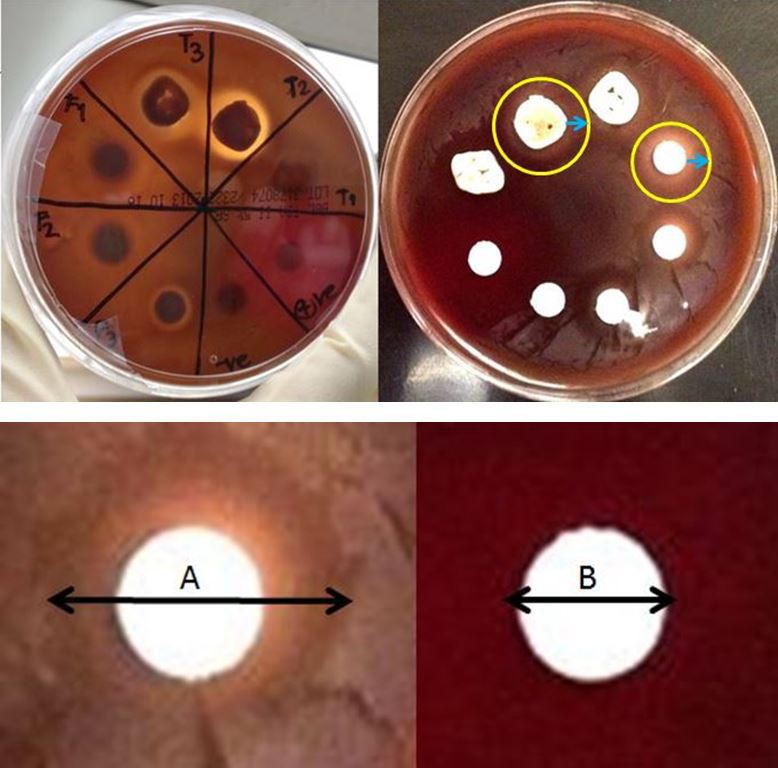 Figure 1 shows a representative plate at one week with very distinct antibacterial properties against streptococcus mutans.  The zone of inhibition is measured as the maximum halo minus the diameter of the tooth section or filter paper disk.