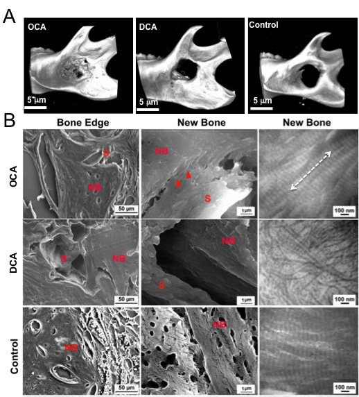 (A)Representative micro-CT images of mandibular defect areas after implantation with different composites for 8 weeks; (B) SEM and TEM analysis of newly-formed bone