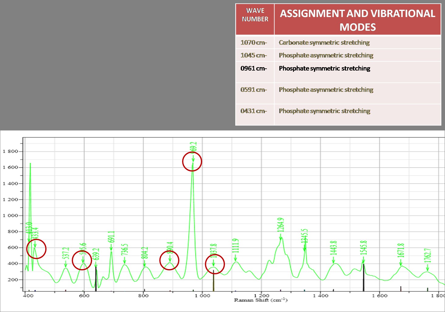 Raman spectrum for a section of caries lesion showing v1 Phosphate(961<sup>-1cm</sup>), Carbonate type B(1070<sup>-1cm</sup>), Carbonate type A(1111<sup>-1cm</sup>)