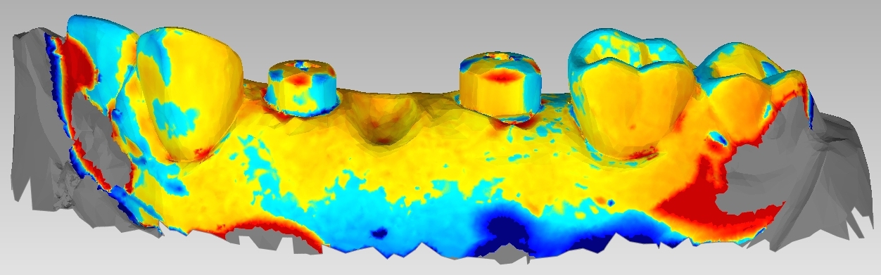 Examplary illustration of a 3D comparison of digital datasets.