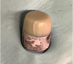 Self-Adhesive Resin Cement Water Sorption Causes Ceramic Dental Crown ...