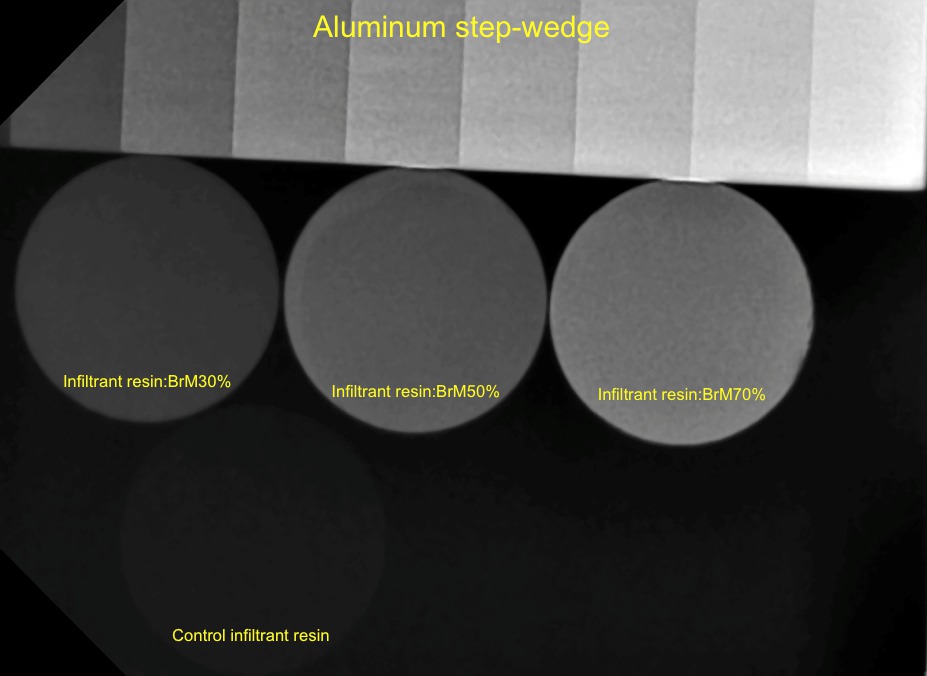 Samples’ radiopacity comparison