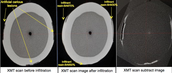 Before & after XMT images