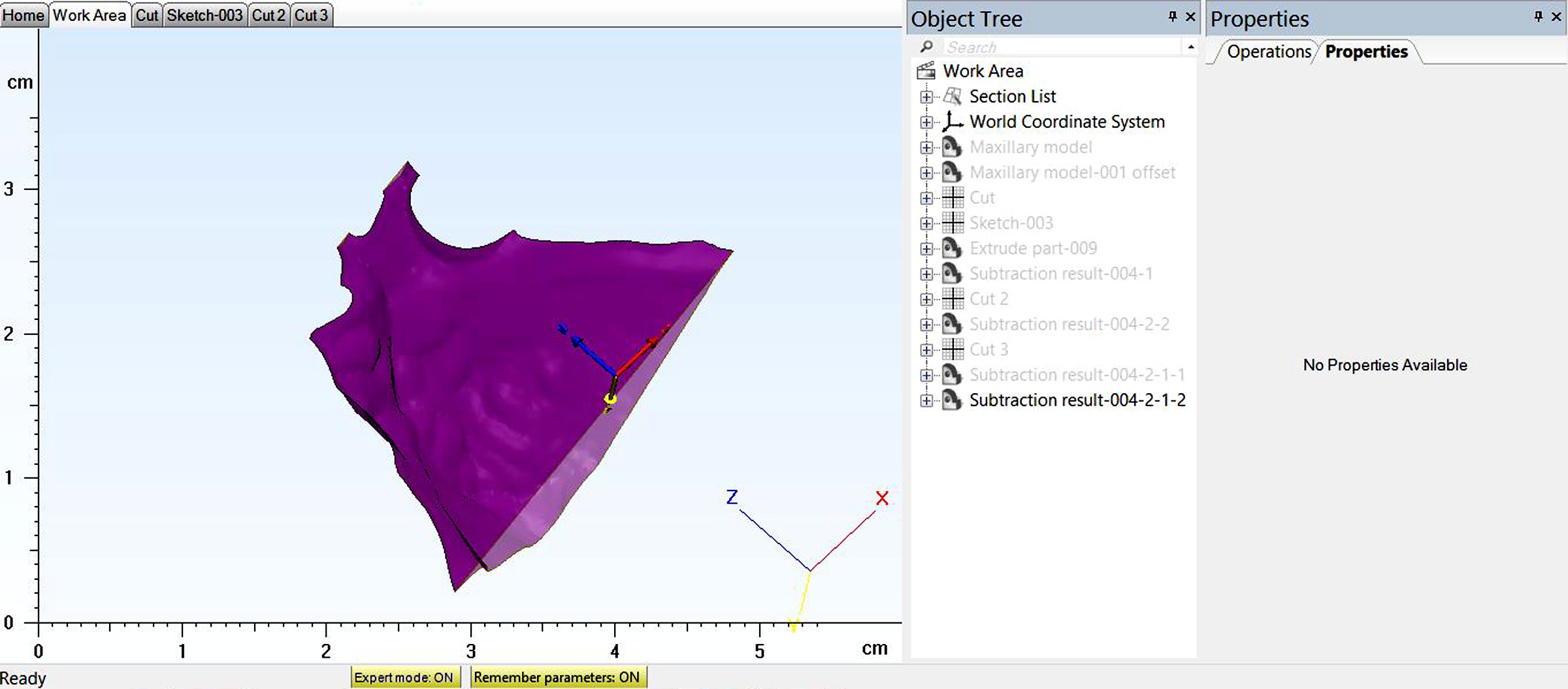 Figure 1: Representative case depicting extracted palatal volume in a UCLP patient<br />