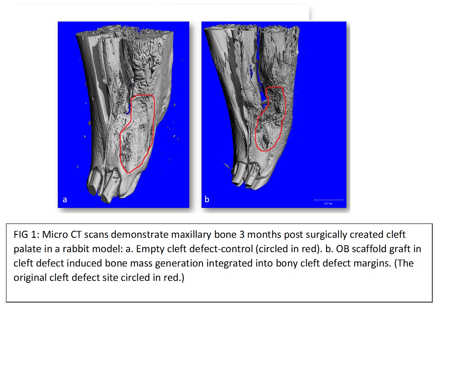 Repairing Cleft Palate Defect By Implementing Ossix Bone Scaffold In A Rabbit Model Iadr Abstract Archives