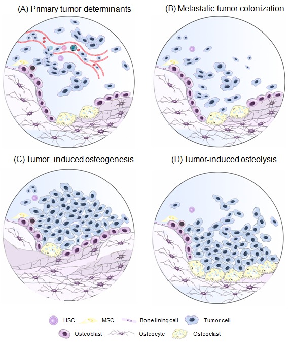 Figure 2. Bone metastasis process.