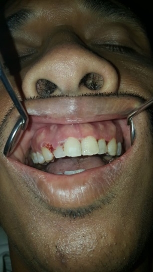 3226344_File000000.jpg