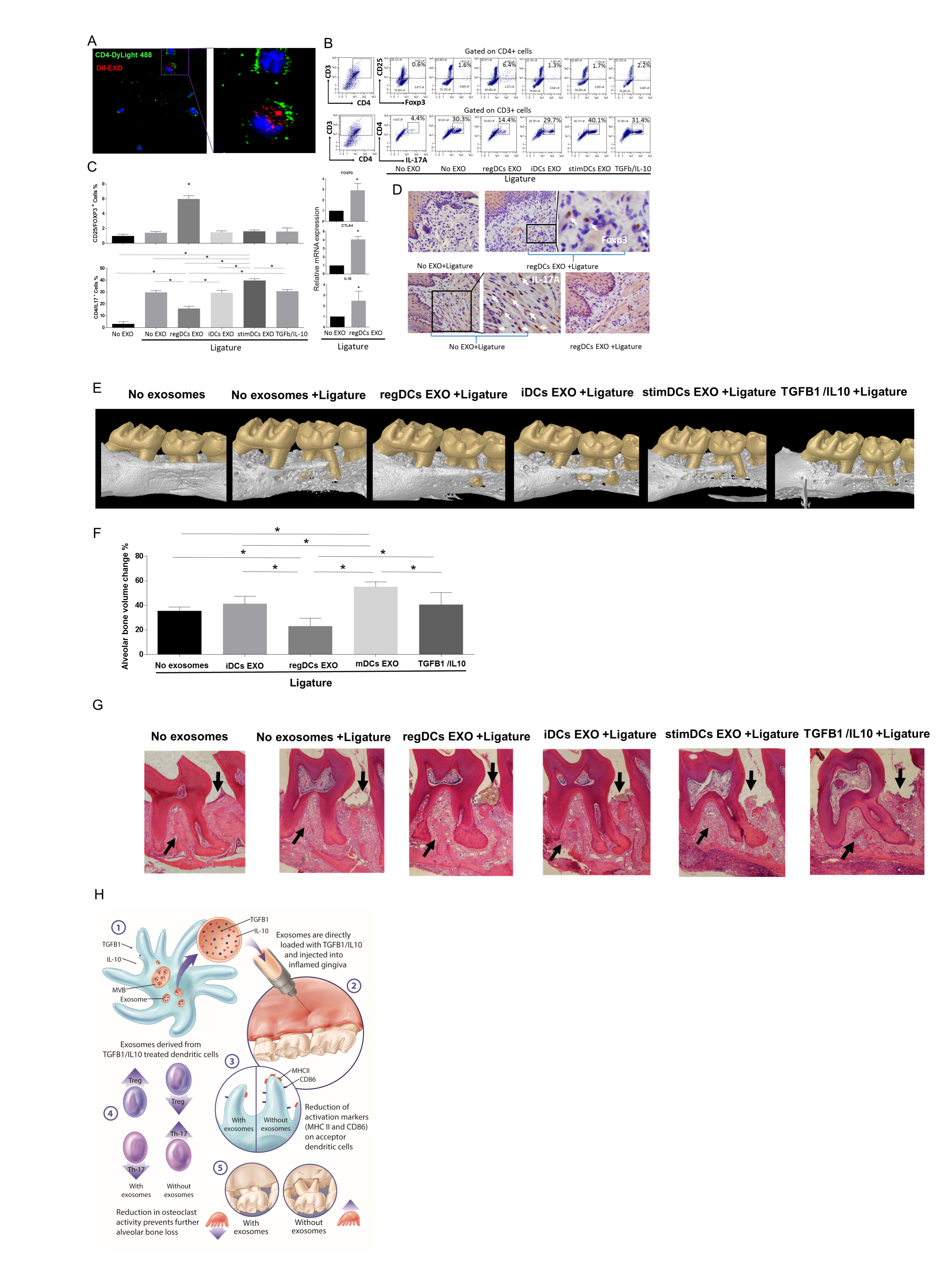 RegDCs EXO interact with gingival CD4 T-cells, inducing Tregs and inhibiting Th17 recruitment and inflamtory bone loss in vivo. (A) Co-localization of EXO with nucleus (DAPI) and CD4 T-cell (green). (B) FC analysis of % Tregs (top panels) and Th17 cells (bottom panels), respectively, in gingival cells. (C) (Left) Bar graphs of % Tregs (upper panel) and % Th17 cells (lower panel) in all groups from (B), and (Right) mRNA levels of Foxp3, CTLA4 and IL-10 in: no EXO treated + ligature group vs regDCs EXO treated + ligature group. (D) IHC staining of Foxp3 (top panels) and IL-17A (bottom panels) in lamina propria of (left) no EXO treated +ligature group and (right) regDCs EXO treated +ligature group. (E) MicroCT generated 3-D images of right maxilla. (F) Bar graphs of % bone volume change around upper right second molar (ligature placement site) by microCT. (G) Histological sections showing bone levels in furcation and interdental area (arrows) (N=5 /group). (H) Summary figure.