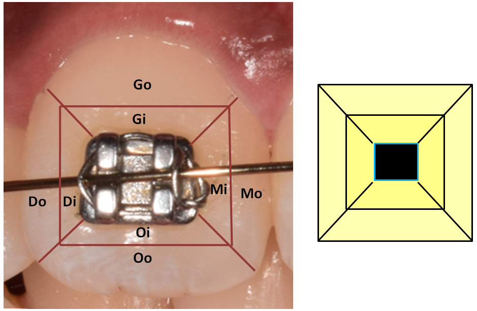Calibration of the tool with pictorial representation of tooth