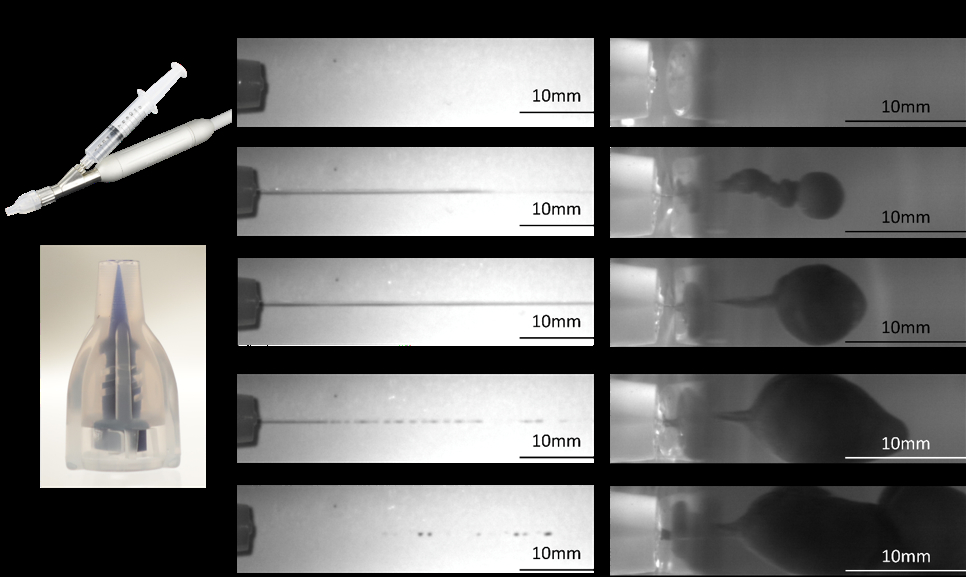 Figure 1 features of the needle-free jet injection: micro-thin and high-speed liquid jet; a) The overall appearance of the needle-free jet injection system; b) The micro-thin nozzle which create the micro thin liquid jet nozzle tip diameter: 60-70um; c) The time course of one injection in the air. The whole injection time of 0.3ml liquid at 90 psi initial pressure is 150ms. The estimation speed of this jet is 110m/s. d) The time course of one injection in 10% gelatine, the whole injection took place within 900ms.<br />