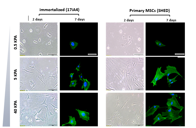 Fig 1: Cellular and nuclear morphology of SHED and 17iA4 cells two days after seeding and also after one week. Blue: DAPI, Green: Phalloidin, cell stretch and show organized stress fibers with increased stiffness from soft, medium and hard substrates. Scale bar images=100 µm