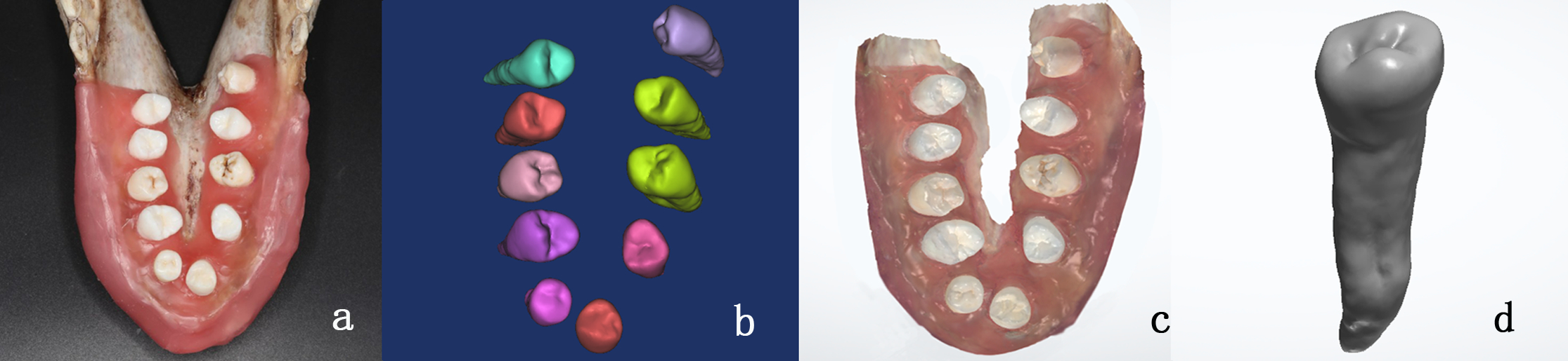 Fig.1<br />
a.simulated dentition model of pig jaw<br />
b.3D CBCT dentition model<br />
c.3D intraoral dentition model<br />
d.3D reference model of extracted intact tooth