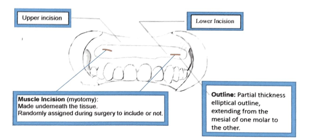 Description of surgical design and two surgical techniques.