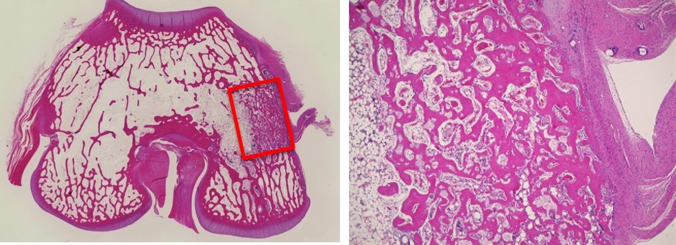 Figure Four weeks H-E stained histological image of porous CO<sub>3</sub>Ap at rabbit tibia’s bone defect.