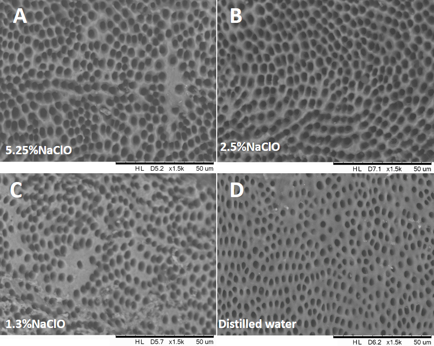 Dentin at the root canal wall was eroded by NaOCl