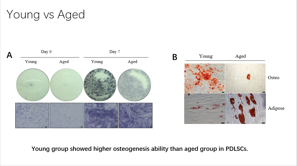 Young VS Aged in Osteogenic ability and adiposegenic ability