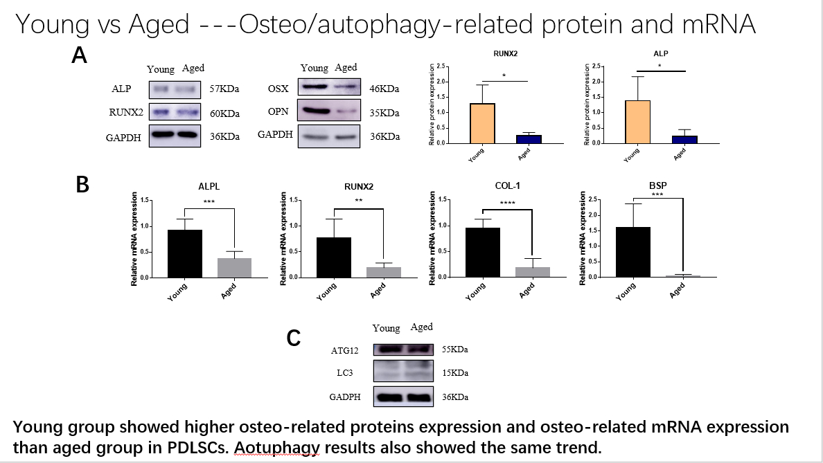 Young vs Aged group in osteo-related proteins and mRNA and in autophagy-related proteins