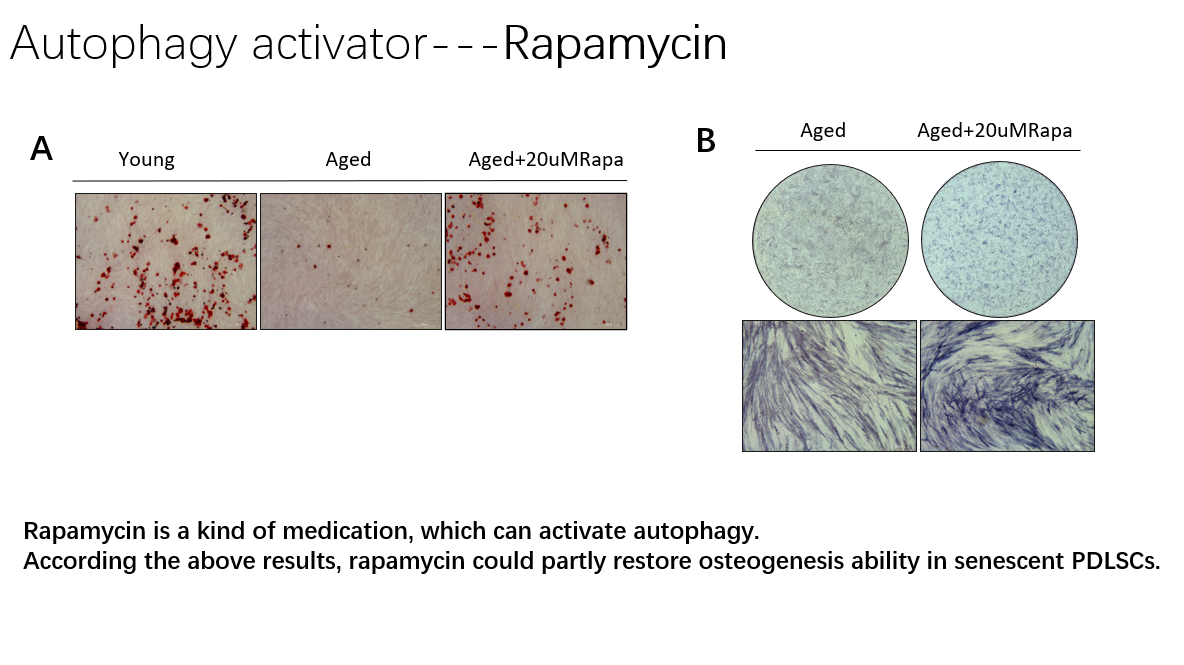 Rapamycin can partly restore the osteogenic ability of aged PDLSCs