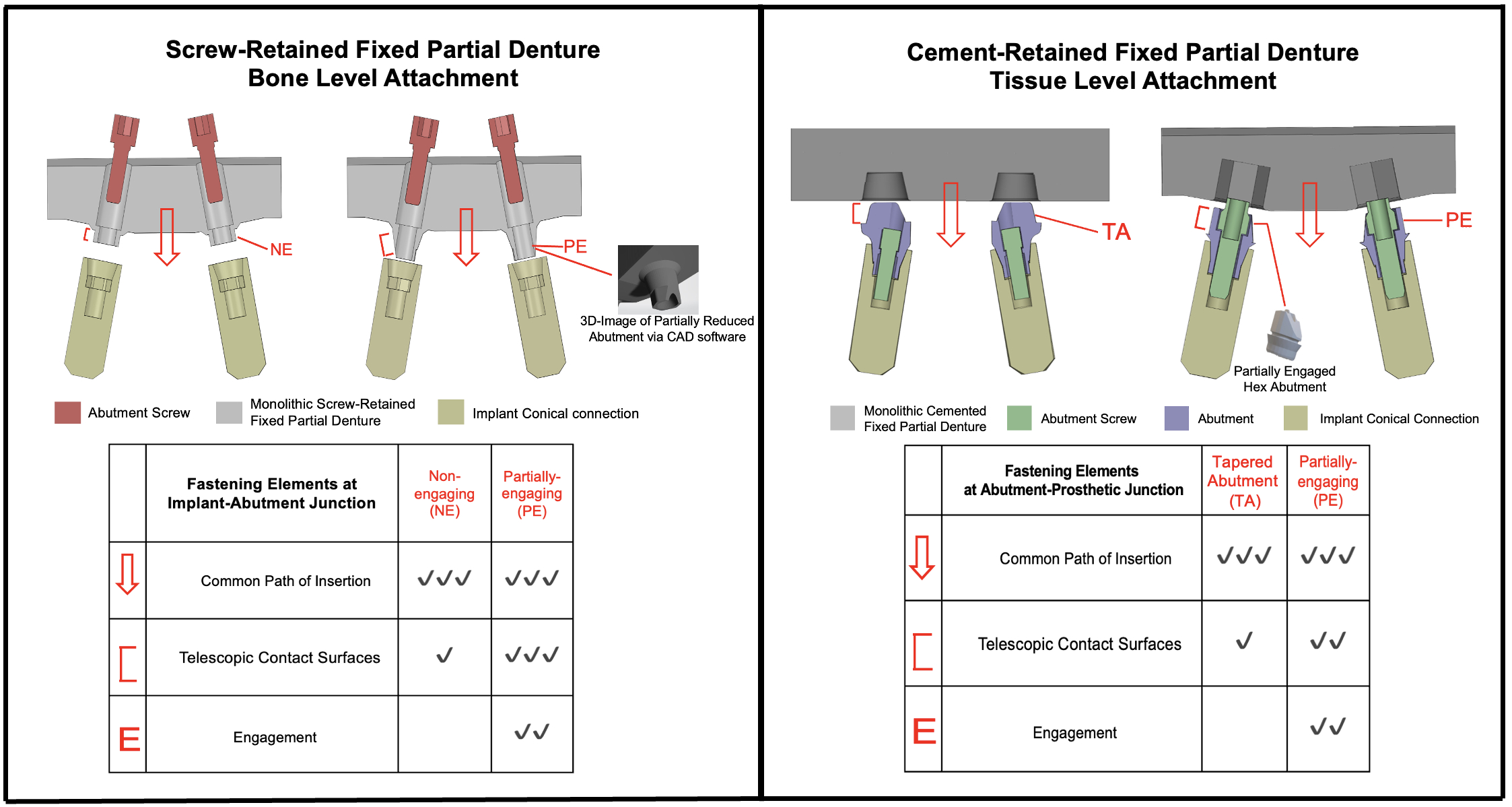 Exploded schematic sectional view of screw and cement-retained FPD sample groups for bone and tissue levels attachments. A table for each sample group representing the number of elements present at each abutment connection and that also qualitatively reflects the stability of the FPD.