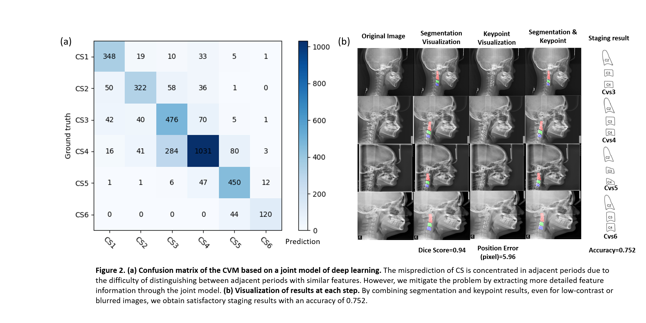 Figure 2. Confusion matrix of the CVM based on joint model deep learning and visualization of results at each step.