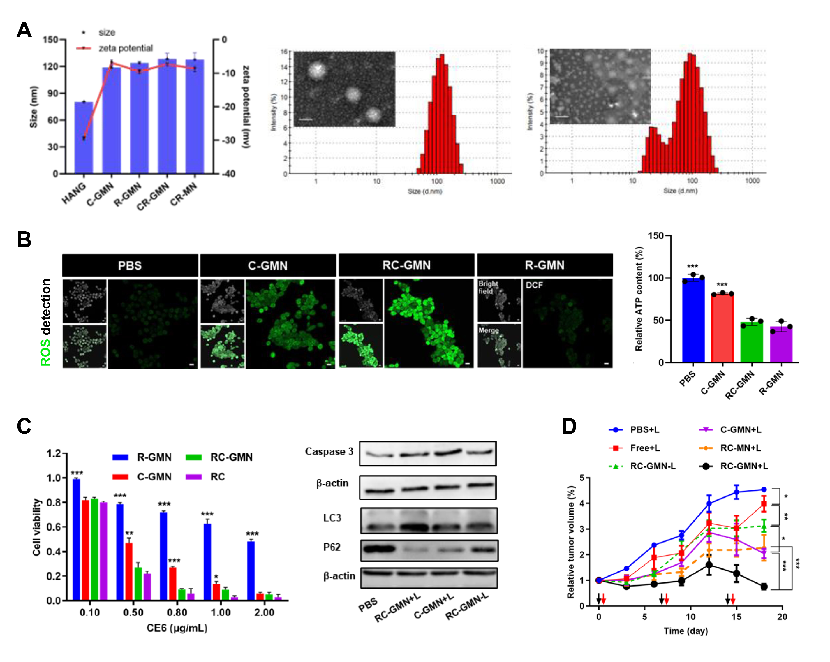 (A) Characterization of RC-GMN. (B) RC-GMN inhibited oxygen consumption and reduced ATP production. (C) RC-GMN simultaneously elevated apoptosis and autophagic cell death. (D) RC-GMN elevated antitumor efficacy in OSCC model