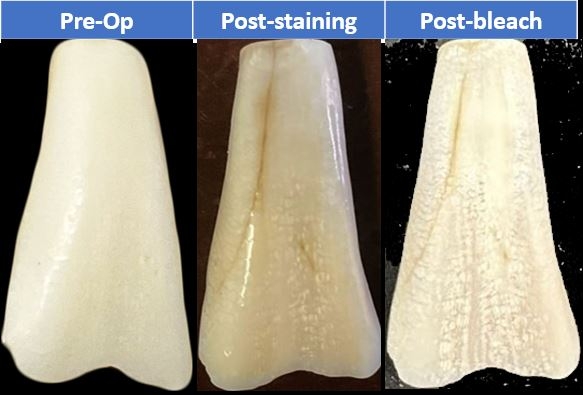 Figure 2.  Representative sample of treatment progression in DW group.