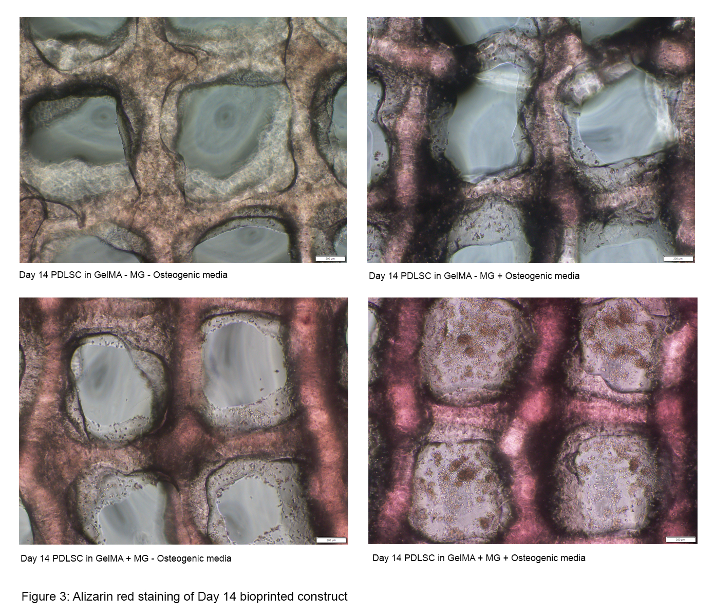 Alizarin red staining of 3D bioprinted constructs under the treatment of mangostin and osteogenic media.