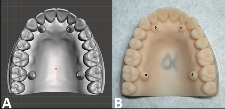Figure 1: Digital (A) and analog (B) diagnostic models denoting measurement points.