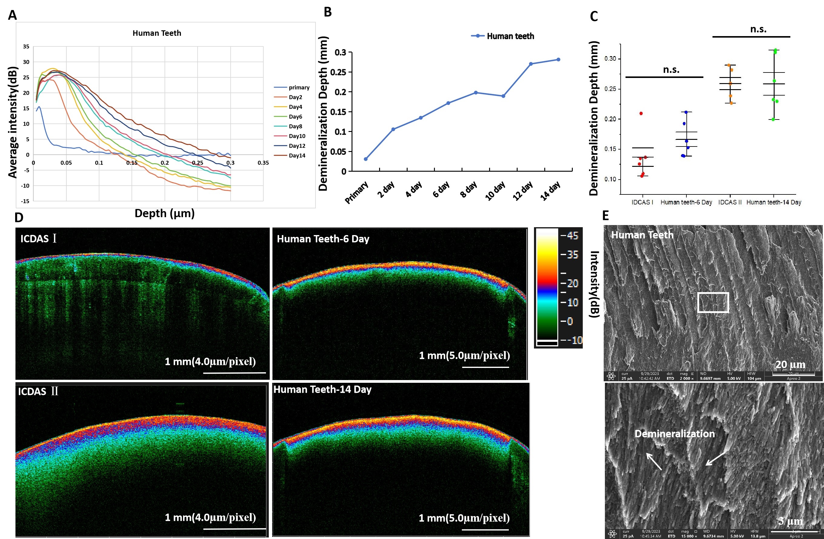 Figure.1. Demineralization and remineralization properties of the PVA-ACP synthetic hydrogel. (A) A-scan changed within 14 days showed demineralization and remineralization process. (B) The demineralization depth changed within 14 days.  (C) The demineralization depth analyzed from the OCT profiles (n = 6 per group). (D) The representative OCT images of the tested groups. B-scan showed OCT images, red indicates the area with high light backscattering or high degree of demineralization, green indicates the area with weak light backscattering or low degree of demineralization. (E) The representative SEM images.