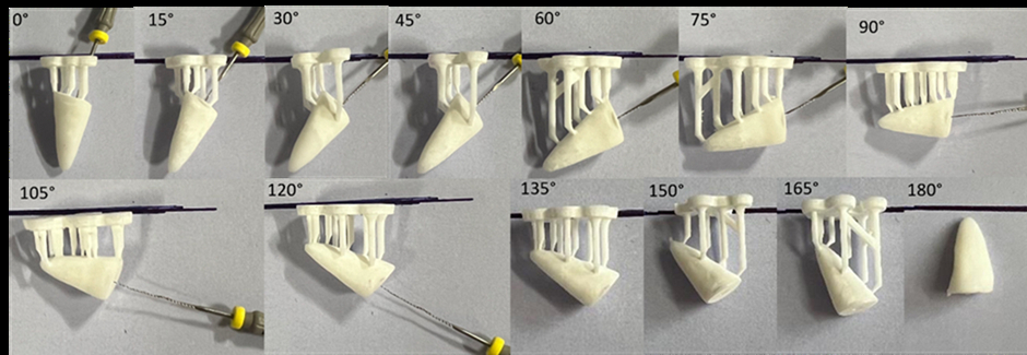 <br />
<br />
Figure 3: The impact of printing orientation on resin drainage and canal patency in the model.