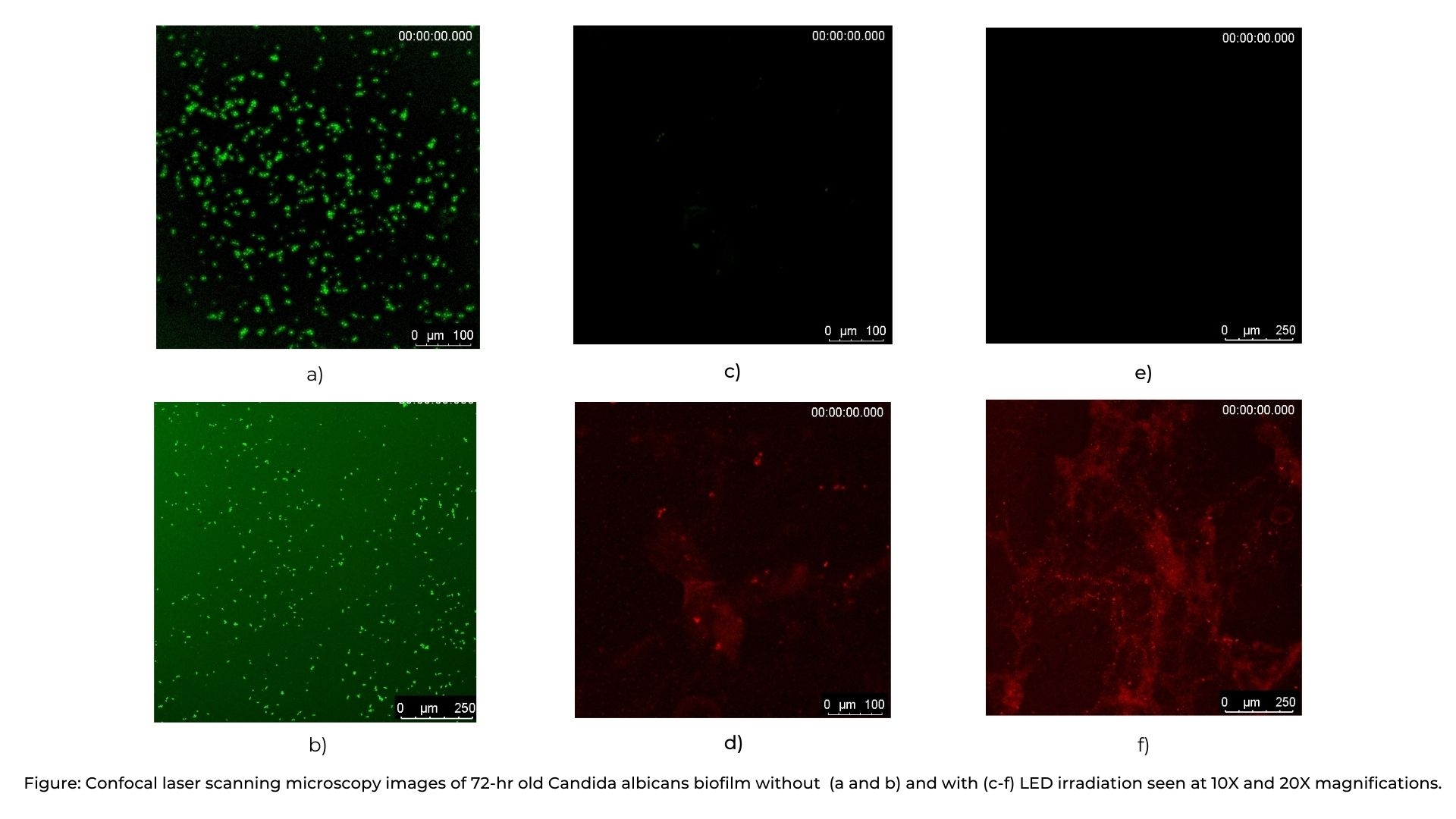 Fig 3: CLSM images of 72-hr old Candida albicans biofilm without (a and b) and with (c-f) LED irradiation seen at 10X and 20X magnifications.