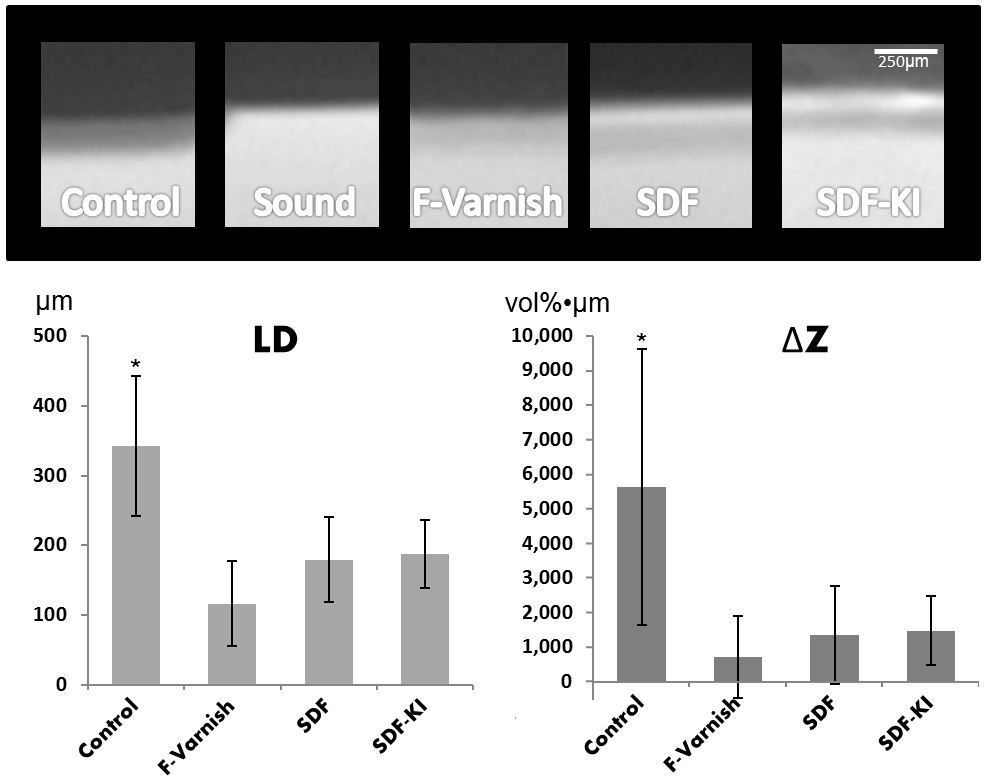 Top: Representative MicroCT images averaged axially over the volume of interest in each group. Bottom: Graphical representation of the results. Asterisk (*) indicates statistical significance (p<0.05).