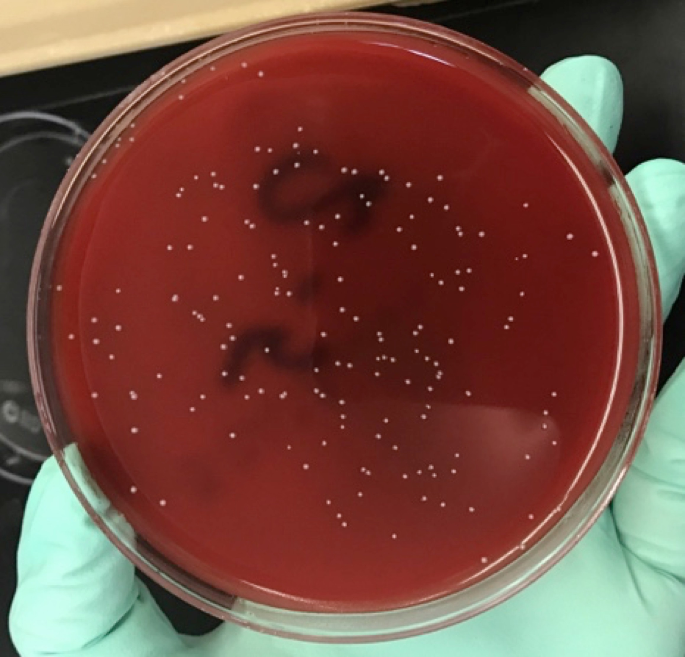 Colonies were counted for biofilm tests.