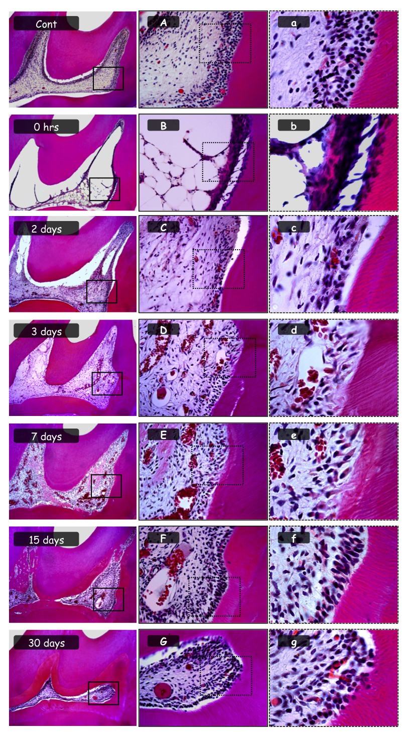 Figure 1. Panoramic microscopic aspect of control group showing normal pulp tissue and (A,a) cervical third of the coronary pulp with organised pulp tissue; 0 h: bleached group immediately after dental bleaching, showing an extensive area of necrosis and (B,b) absence of cellularity; 2 and 3 days : bleached group at 2 and 3 days with regions of necrosis in the disorganized pulp tissue and (C,c; D,d) evident tissue disorganisation; 7 days: bleached group at 7 days showing organised pulp tissue and areas of tertiary dentine, and (E,e) cervical third of the coronary pulp with the formation of odontoblastic-like cells; 15 days: bleached group at 15 days with intact pulp tissue and presence of tertiary dentine, and (F,f) higher magnification showing pulp organisation; 30 days: bleached group at 30 days with tissue organisation and (G,g) absence of inflammation and deposition of tertiary dentine. (100×, 400×, 1000×: haematoxylin–eosin [H.E.])