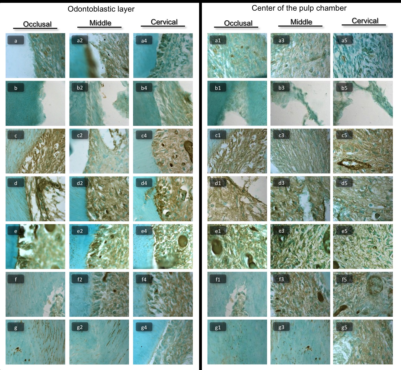 Figure 2. Representative images of immunohistochemical analyses of Jun-D in the (a,a2,a4-g,g2,g4) odontoblastic layer and (a1,a3,a5-g1,g3,g5) center of the pulp chamber. Images of (a,a1-g,g1) occlusal, (a2,a3-g2,g3) middle and (a4,a5-g4,g5) cervical thirds of pulp chamber of the (a-a5) control group and bleached group (b-b5) immediately, (c-c5) at 2 days, (d-d5) 3 days, (e-e5) 7 days, (f-f5) 15 days and (g-g5) 30 days after bleaching. (1000×:immunohistochemical of Jun-D) <br />