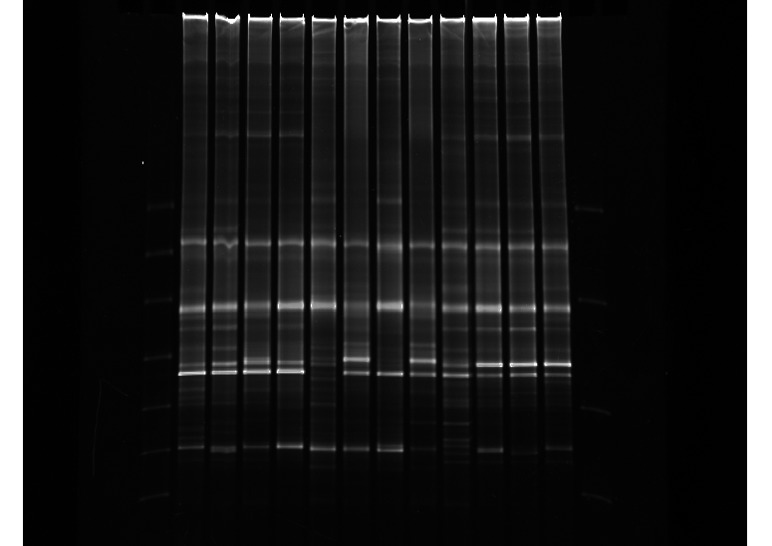 This gel shows the 1st DGGE fingerprint. Lanes 1 and 14 contain markers. Lanes 2-5 represent the nonsmoking cohort. Lanes 6-9 represent the cigarette smoking cohort. Lanes 10-13 represent the electronic cigarette cohort. Although the same markers are used in second DGGE fingerprint, the samples in each lane are distinct.