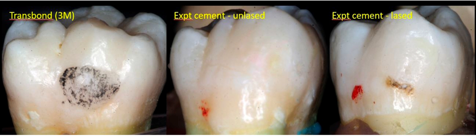 Figure 2: Post-Polishing Tooth Surfaces of the control (3M) and un-lased and lased groups (Cao)