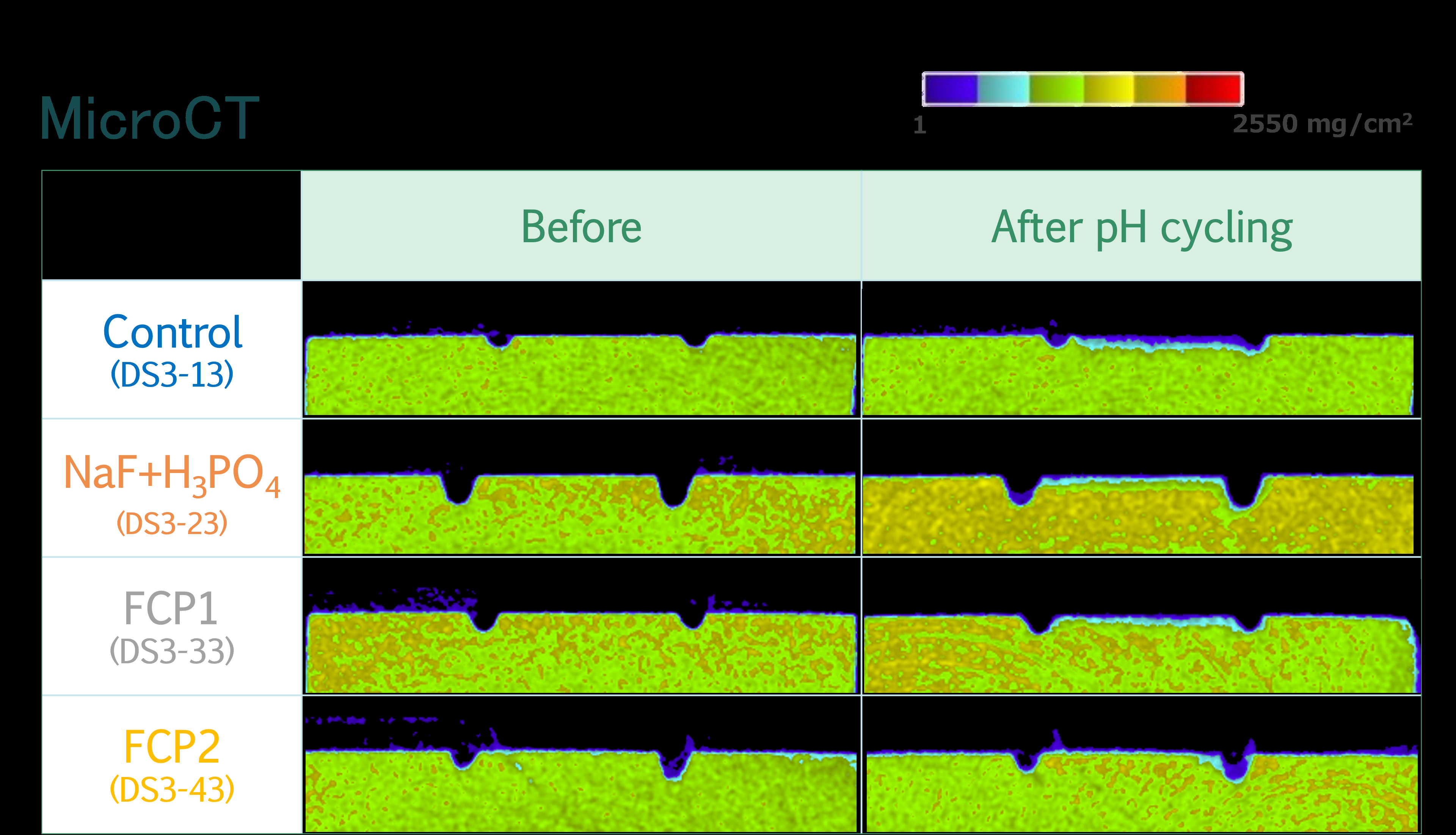 Micro-CT images for Mineral loss and Lesion depth
